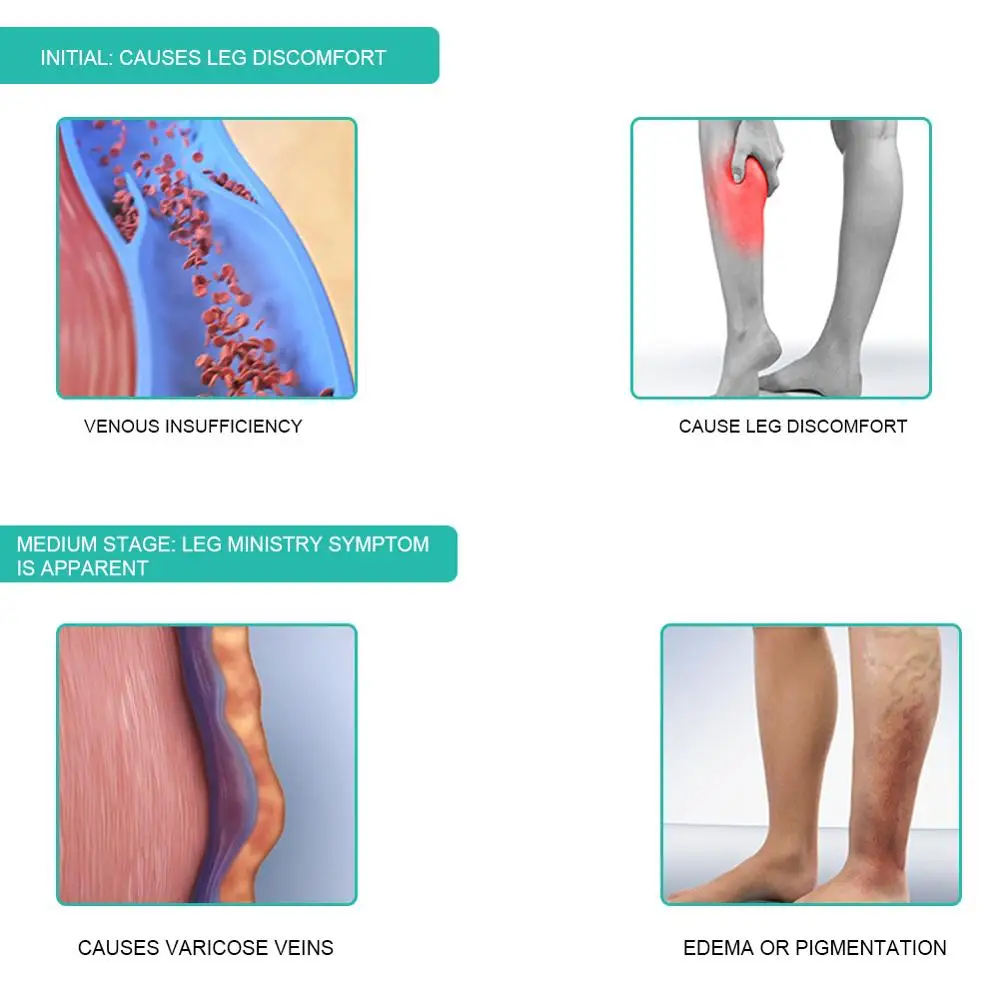 1 paar Medizinische Kompressio – Compression Sleeve Calf Bewertung und Preis