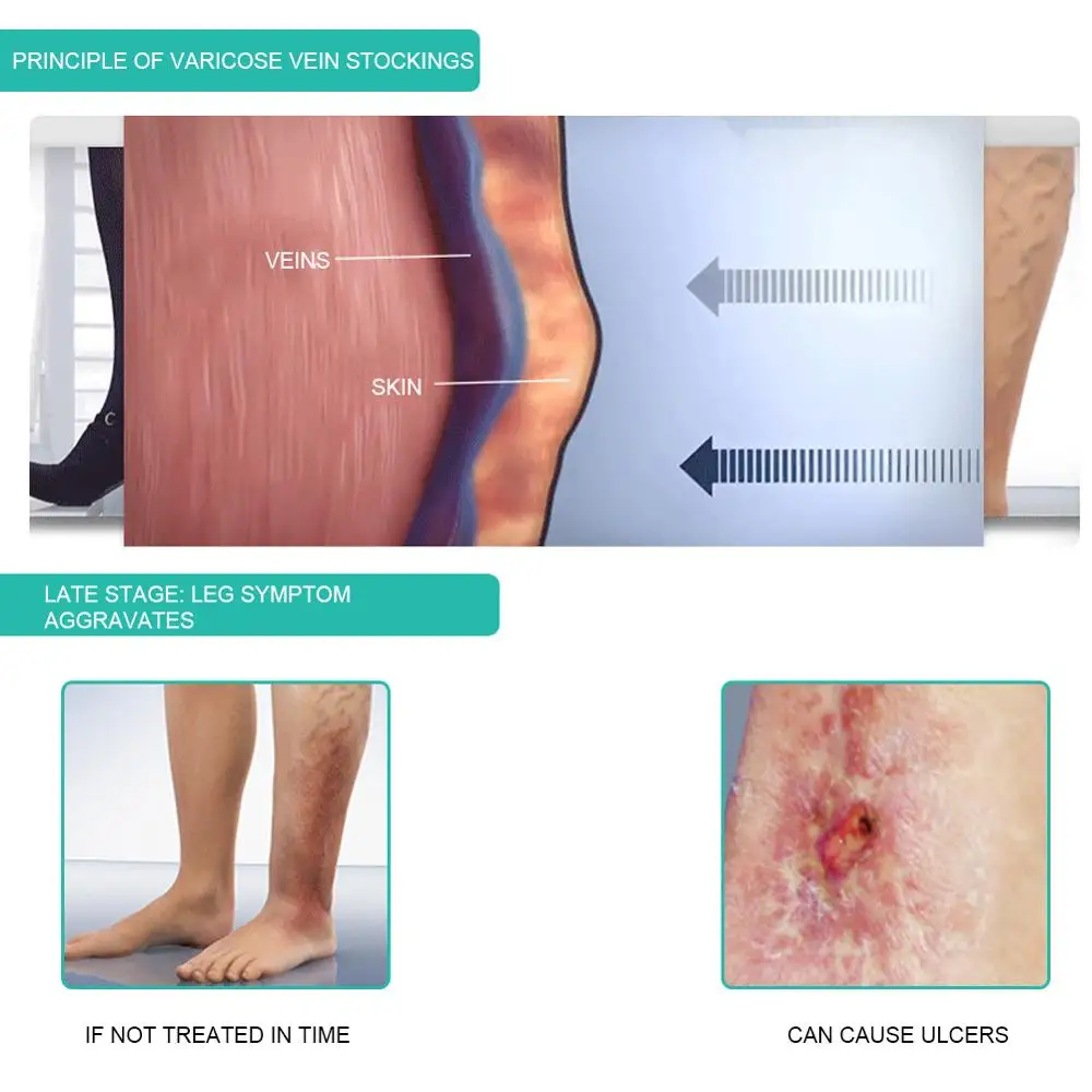 1 paar Medizinische Kompressio – Compression Sleeve Calf Bewertung und Preis